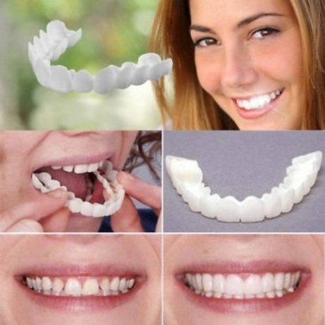 Snap-On-Smile – Elbűvölő fogsor házilag, 2 perc alatt (x)