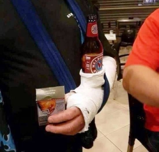 Kért egy kis extrát is, amikor begipszelték a törött kezét