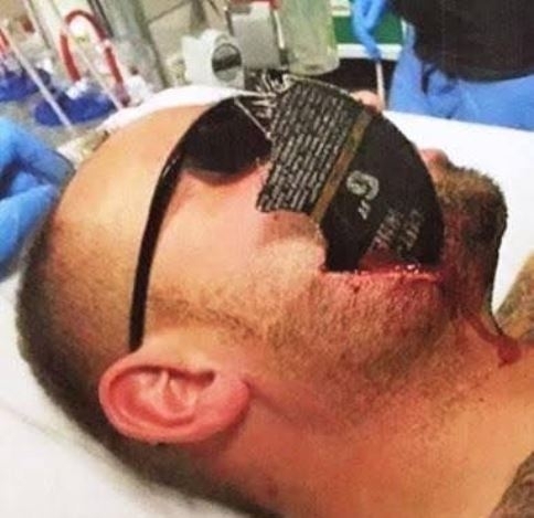 Egy brutális melóhelyi baleset